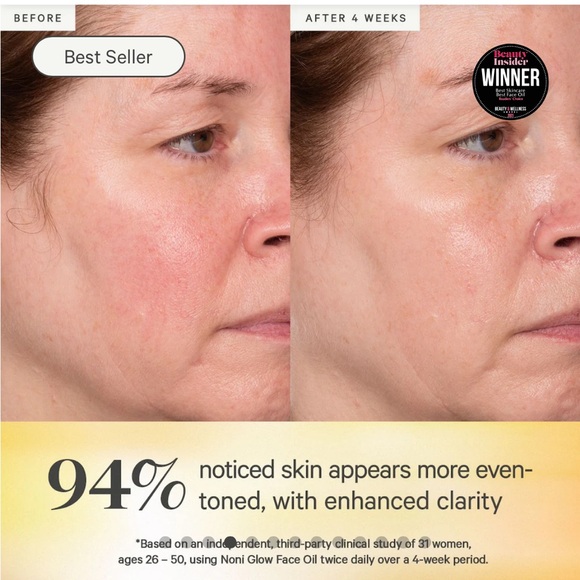 KORA Organics Noni Glow Face Oil - Picture 6 of 9